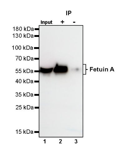 Fetuin A Recombinant Rabbit mAb (S-1109-5)