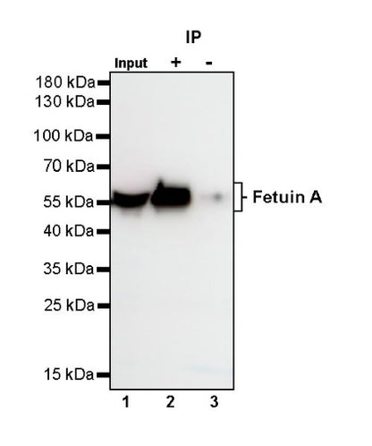 Fetuin A Recombinant Rabbit mAb (S-1109-5)