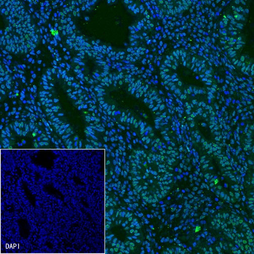 Estrogen Receptor α Recombinant Rabbit mAb (Alexa Fluor® 488 Conjugate) (SDT-R371)