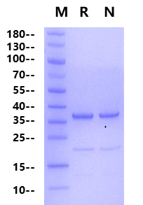 RIPK2 Flag Tag Protein, Human