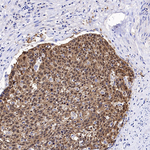 14-3-3 sigma Rabbit Polyclonal Antibody