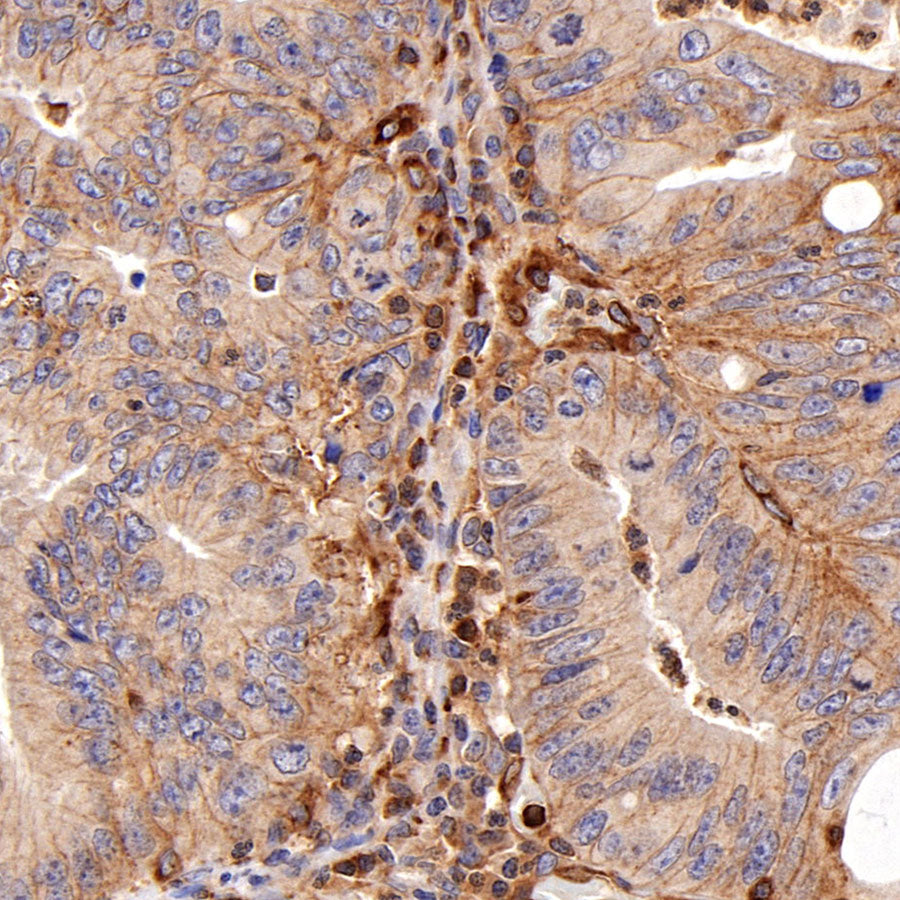 Moesin Rabbit Polyclonal Antibody