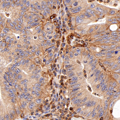 Moesin Rabbit Polyclonal Antibody