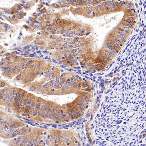 TIM-1 Recombinant Rabbit mAb (S-1555-147)