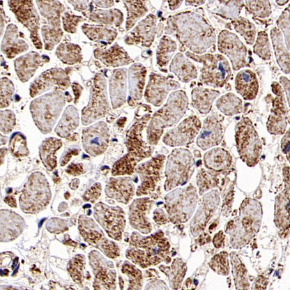 Hexokinase II Rabbit Polyclonal Antibody