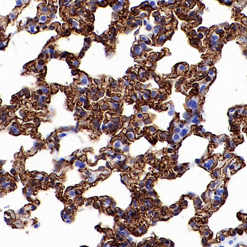Claudin 5 Recombinant Rabbit mAb (SDT-R322)