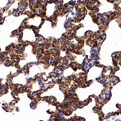 Claudin 5 Recombinant Rabbit mAb (SDT-R322)