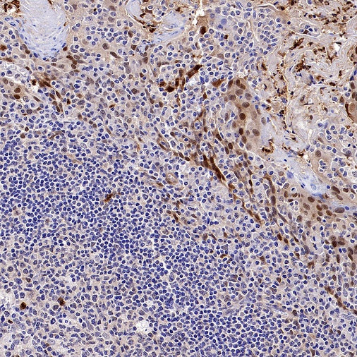PBEF/Visfatin/NAMPT Rabbit Polyclonal Antibody