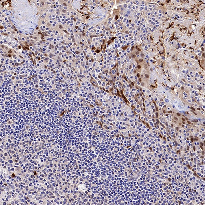 PBEF/Visfatin/NAMPT Rabbit Polyclonal Antibody