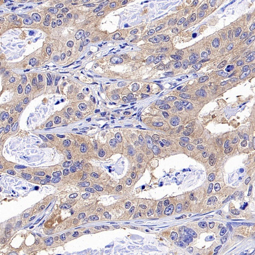 JAK1 Recombinant Rabbit mAb (S-1819-142)