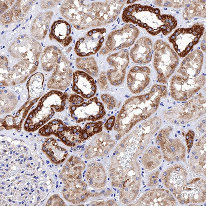 Bad Recombinant Rabbit mAb (S-976-26)