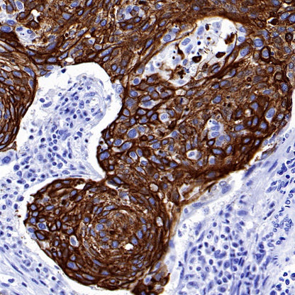 CK-13 Recombinant Rabbit mAb (SDT-R282)