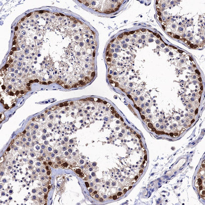ATIC Rabbit Polyclonal Antibody