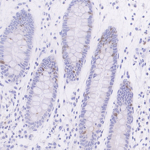 Cyclin A2 Recombinant Rabbit mAb (S-1873-103)