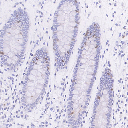 Cyclin A2 Recombinant Rabbit mAb (S-1873-103)
