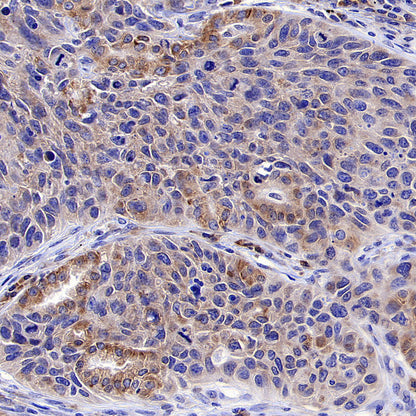 CCDC47 Recombinant Rabbit mAb (S-4158-17)