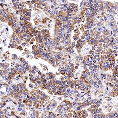 STING Recombinant Rabbit mAb (S-1392-33)