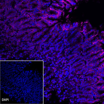Claudin 18.2 Recombinant Rabbit mAb (Alexa Fluor® 647 Conjugate) (S-102-24)
