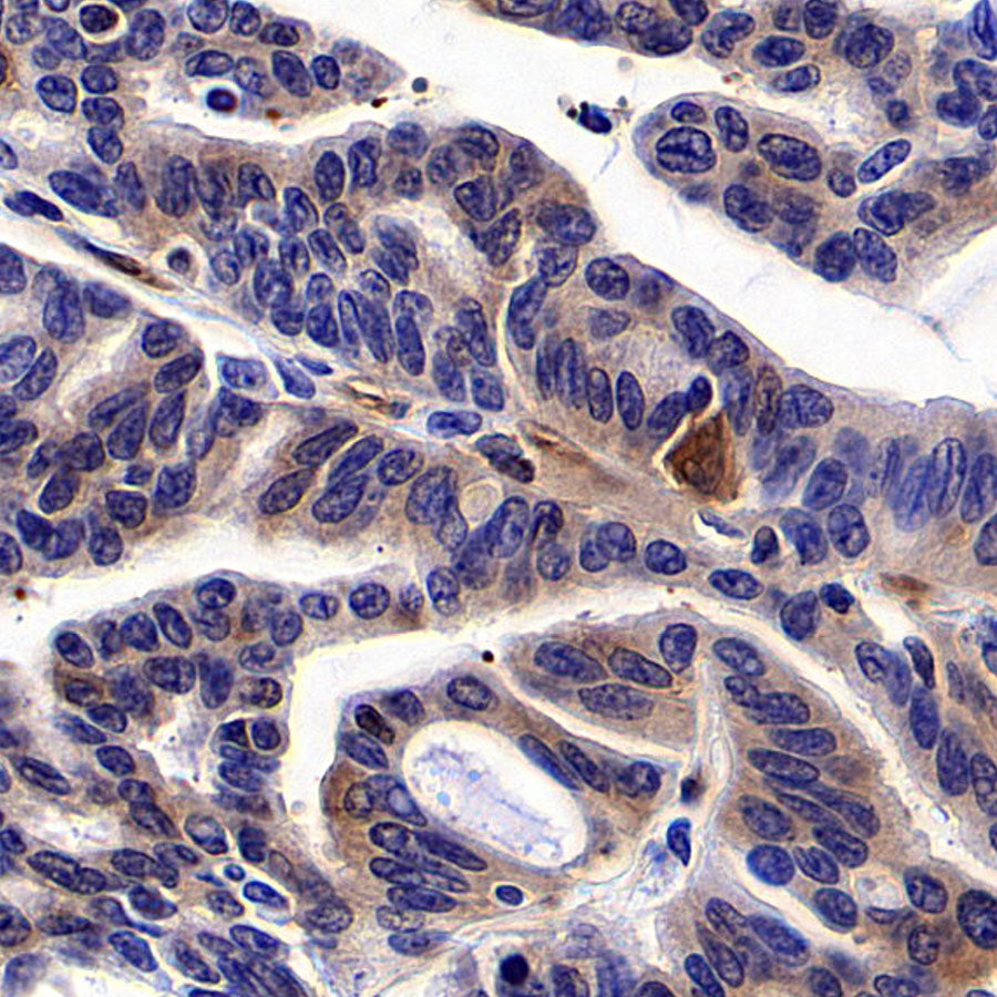 NF-kB p65 Recombinant Rabbit mAb (S-5142)