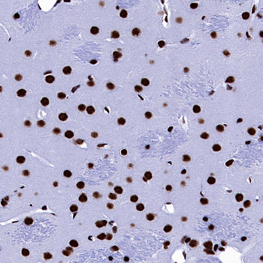 DDX39B Recombinant Rabbit mAb (S-4549-30)