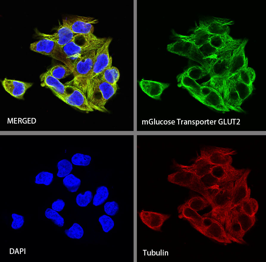 GLUT2 Recombinant Rabbit mAb (SDT-R036)