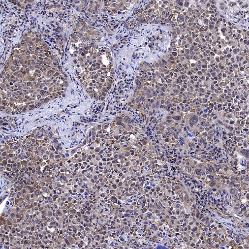 mTOR Recombinant Rabbit mAb (S-698-228)