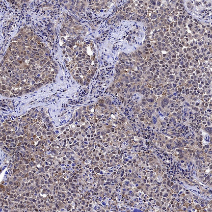 mTOR Recombinant Rabbit mAb (S-698-228)