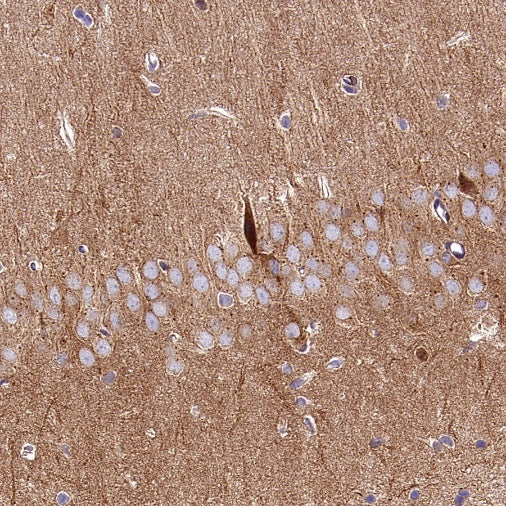 PKA C-α Recombinant Rabbit mAb (S-2564-5)