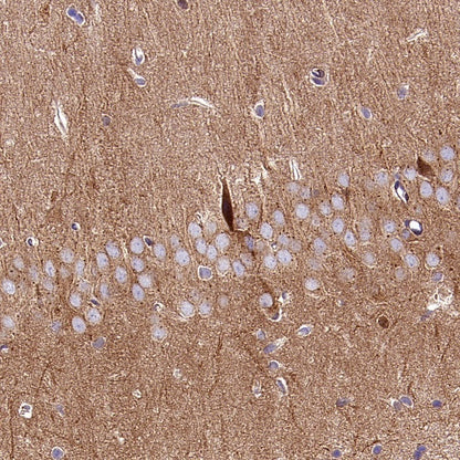 PKA C-α Recombinant Rabbit mAb (S-2564-5)