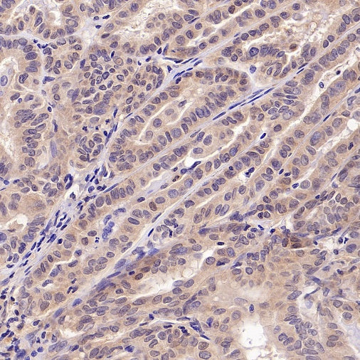 UBE2F Recombinant Rabbit mAb (S-2672-26)
