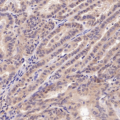 UBE2F Recombinant Rabbit mAb (S-2672-26)