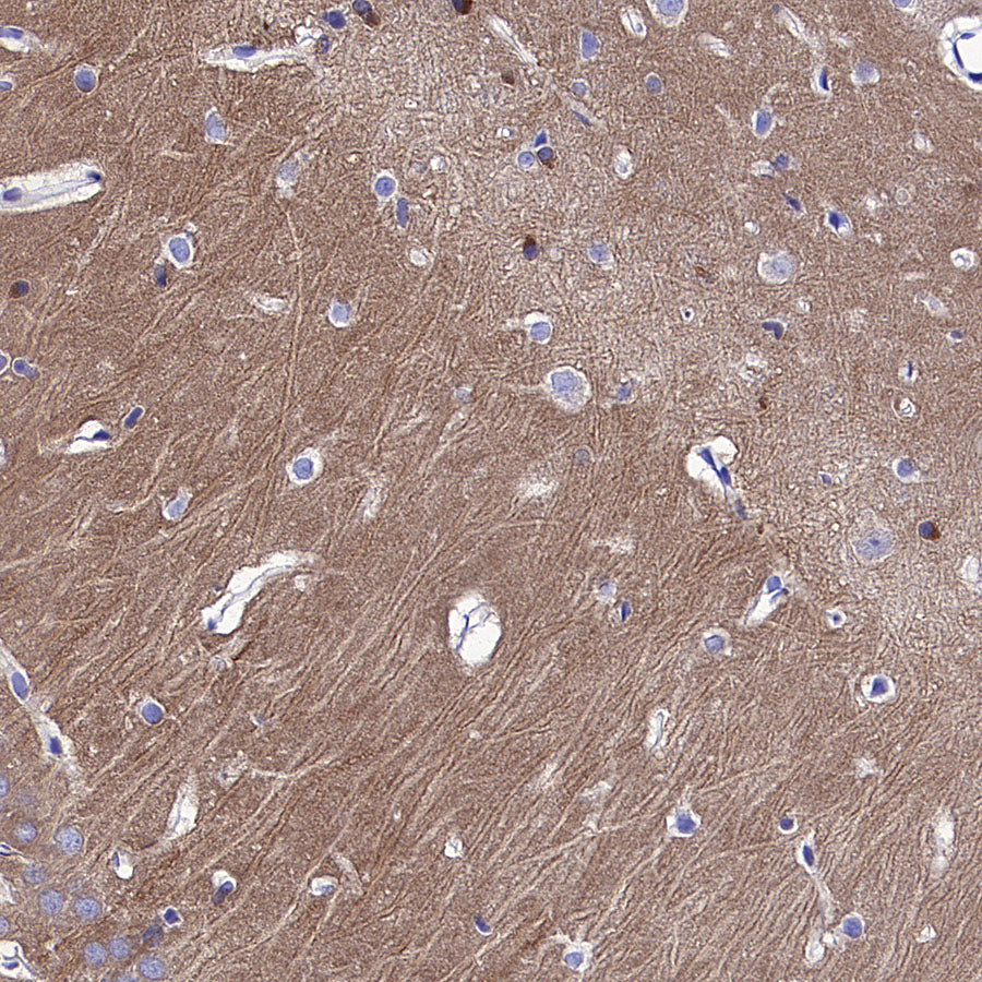 pan PDE4 Recombinant Rabbit mAb (S-5034)