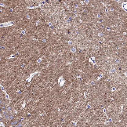pan PDE4 Recombinant Rabbit mAb (S-5034)