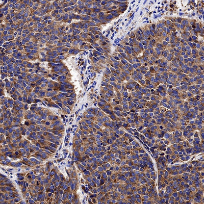 Calreticulin Recombinant Rabbit mAb (S-779-273)