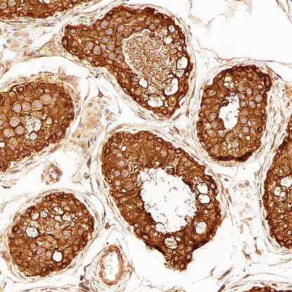 p58IPK/DNAJC3 Recombinant Rabbit mAb (S-4816-205)