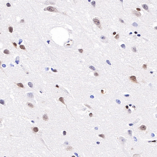 CREB Recombinant Rabbit mAb (S-747-60)