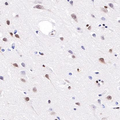 CREB Recombinant Rabbit mAb (S-747-60)