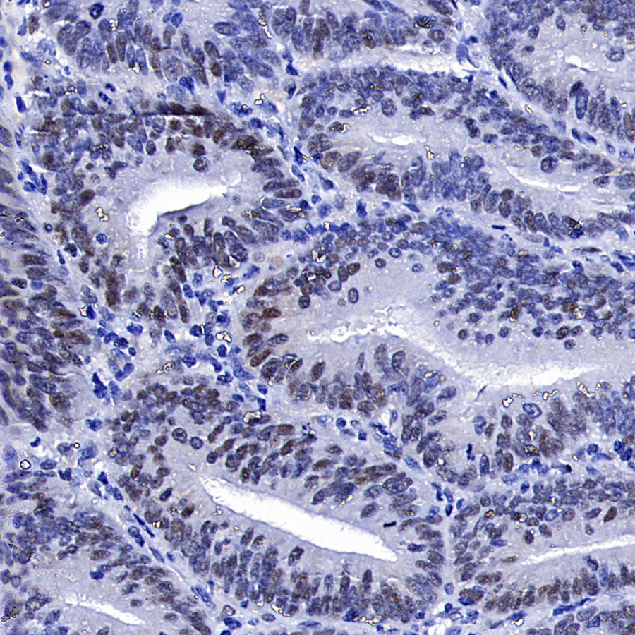 Cyclin E1 Recombinant Rabbit mAb (SDT-4375-44)