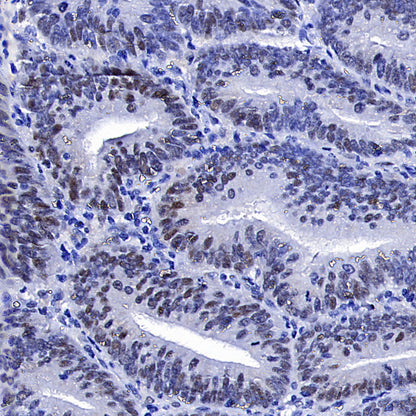 Cyclin E1 Recombinant Rabbit mAb (SDT-4375-44)