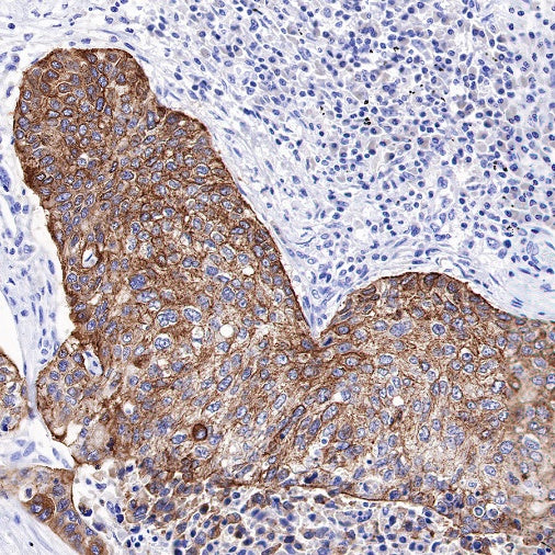TRIM29 Recombinant Rabbit mAb (S-642-43)