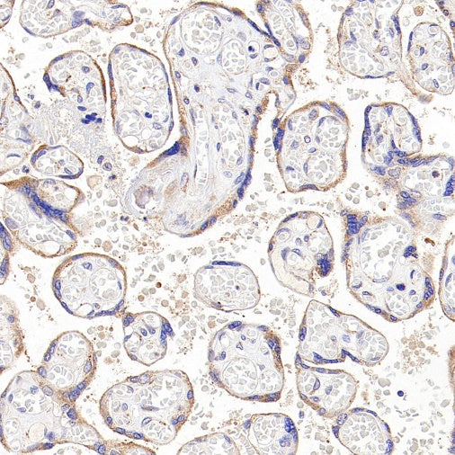 TGFBR2 Recombinant Rabbit mAb (S-1711-55)