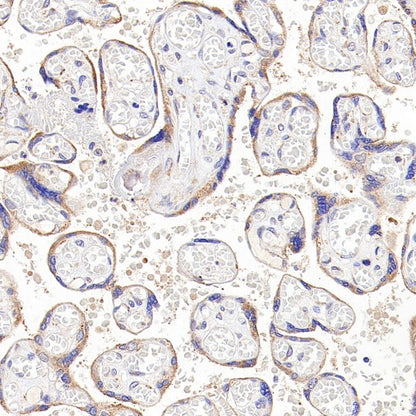 TGFBR2 Recombinant Rabbit mAb (S-1711-55)