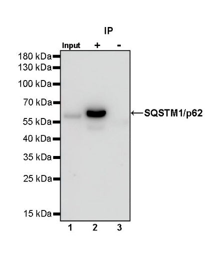 SQSTM1/p62 Recombinant Rabbit mAb (S-778-1)
