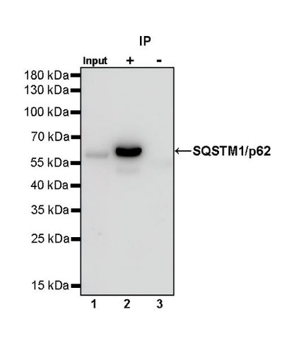 SQSTM1/p62 Recombinant Rabbit mAb (S-778-1)