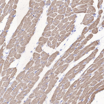 Myosin light chain 3 Recombinant Rabbit mAb (S-664-75)