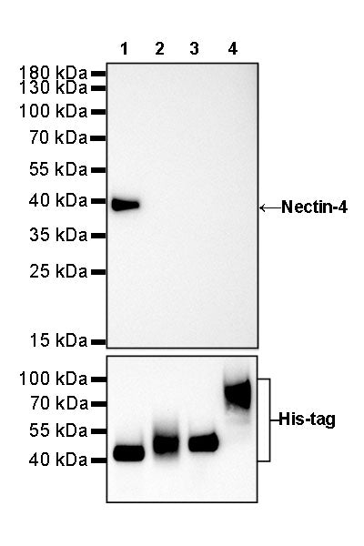 Nectin-4 Recombinant Rabbit mAb (SDT-277-229)