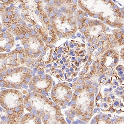 Beta II tubulin Recombinant Rabbit mAb (S-1055-2)