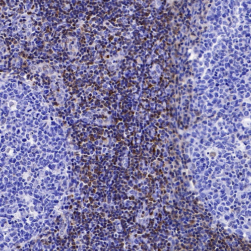 PDCD4 Rabbit polyclonal antibody