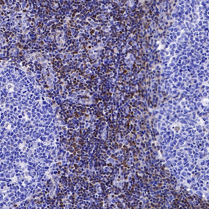 PDCD4 Rabbit polyclonal antibody