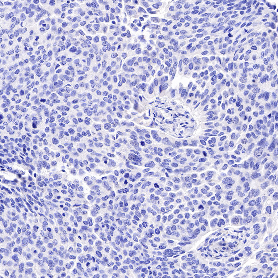 Asialoglycoprotein Receptor 1 Recombinant Rabbit mAb (SDT-292-48)